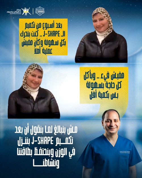 مميزات تكميم المعدة J shape