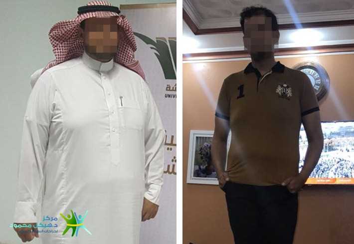 high body mass index