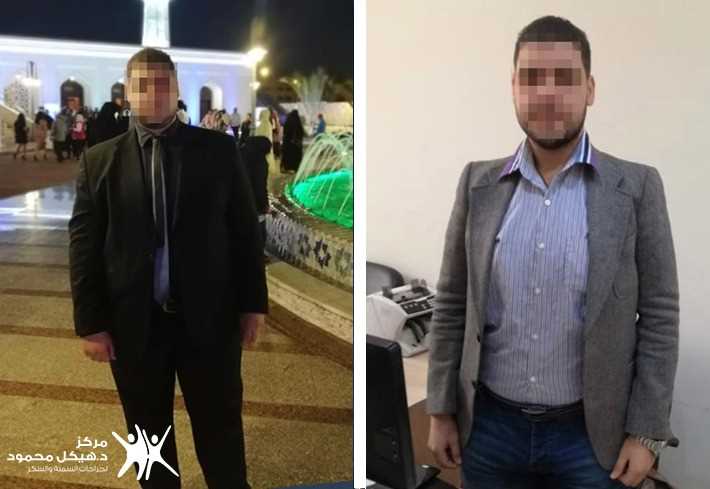 success story of Gastric Sleeve